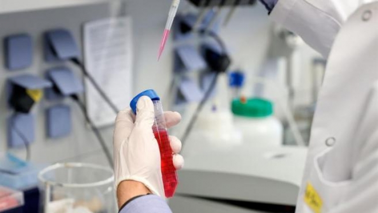Oxford continuar&aacute; con ensayos de vacuna covid pese a muerte de voluntario