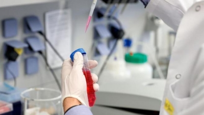 Oxford continuar&aacute; con ensayos de vacuna covid pese a muerte de voluntario