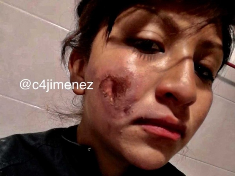 En redes sociales mujer polic&iacute;a de la CDMX muestra las heridas causadas por "feministas" durante la marcha
