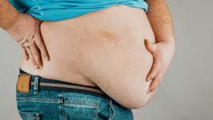 Especialista en Nutrici&oacute;n de la UAS explica la clasificaci&oacute;n y diferencia de la obesidad en cl&iacute;nica y precl&iacute;nica