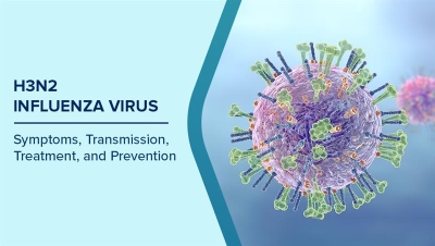 Secretaria de Salud confirma primer caso de influenza H3N2 subclado K en M&eacute;xico