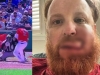 Justin Turner muestra c&oacute;mo le qued&oacute; la cara tras recibir pelotazo; requiri&oacute; 16 puntadas