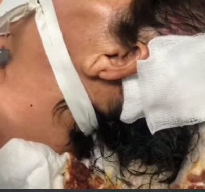 Familiares de pacientes enviaron a Vivavoz una denuncia de una mujer agusanada en el IMSS de Culiac&aacute;n
